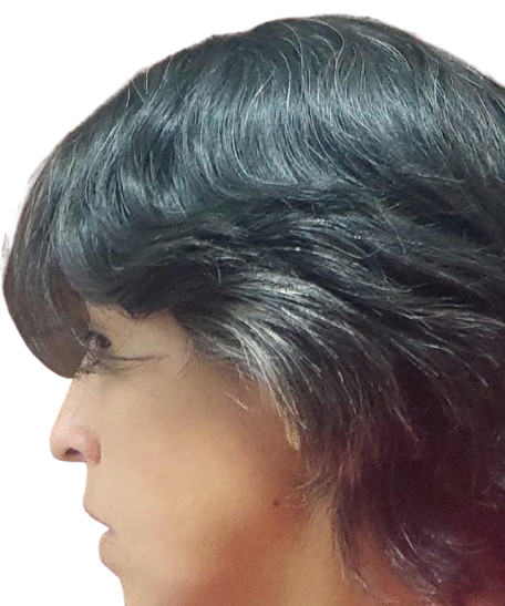 A 3 meses